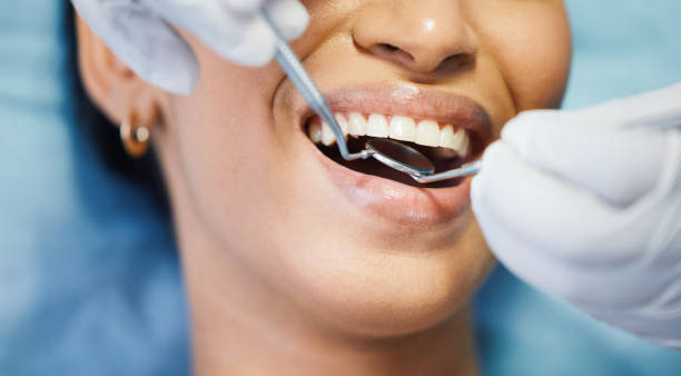 Best Knocked-Out Tooth (Avulsed Tooth) Treatment in Eagle, WI